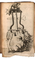 trepanation